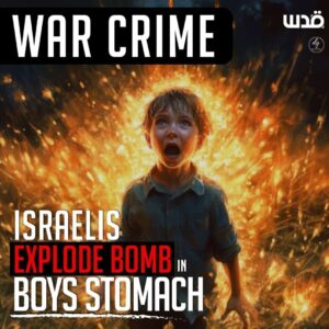 WAR CRIME
ISRAELIS EXPLODE BOMB IN BOYS STOMACH