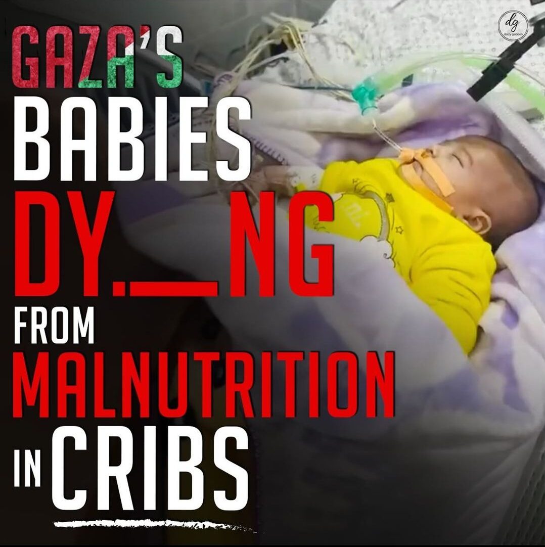 GAZAS-BABIES-DYING-FROM-MALNUTRITION-IN-CRIBS-e1708503093696