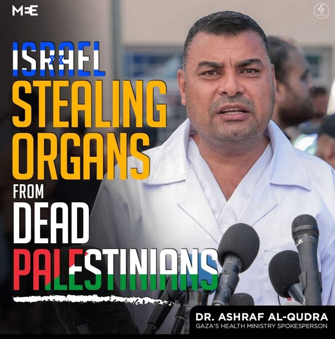 ISRAEL-STEALING-ORGANS-FROM-DEAD-PALESTINIANS-e1713948477224