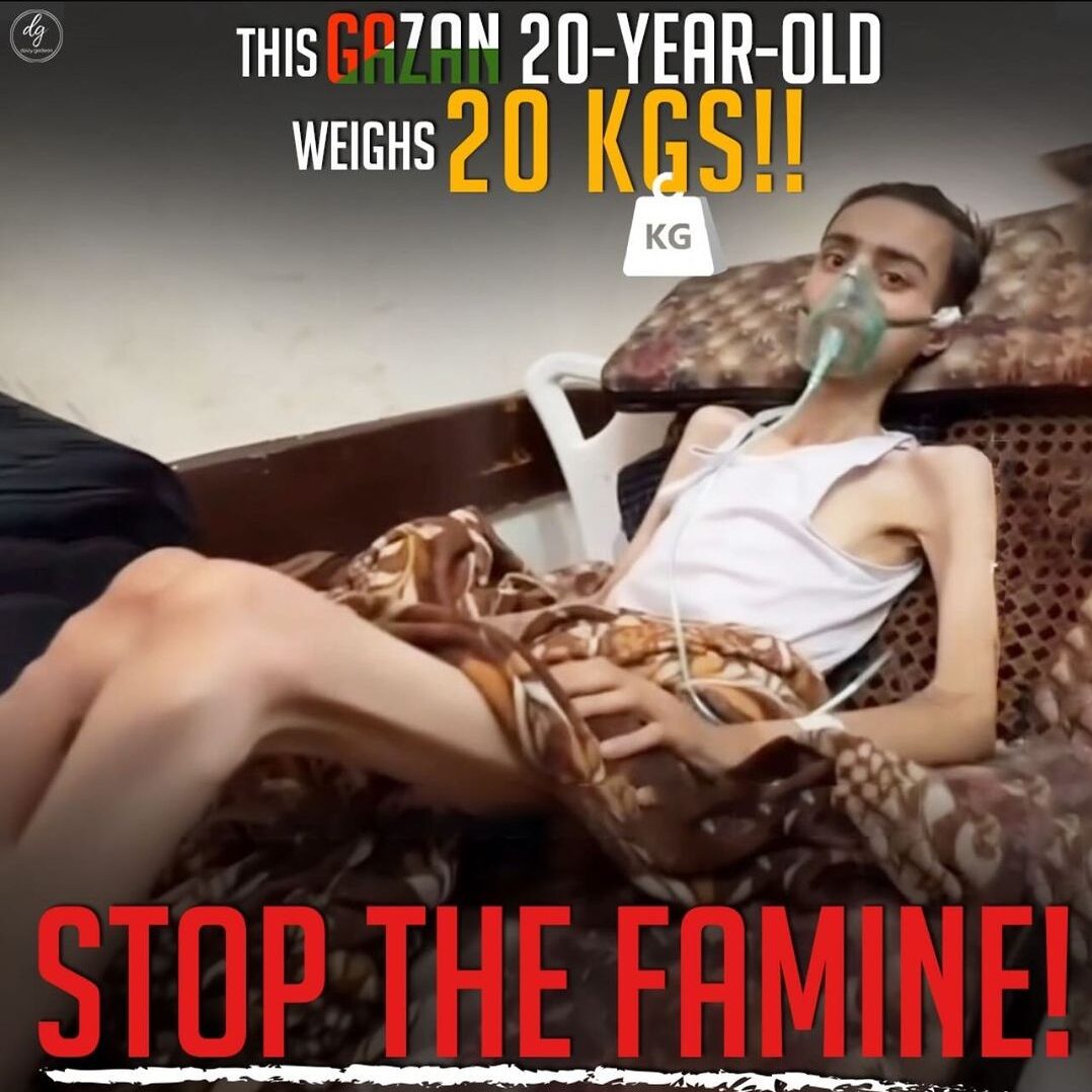 THIS-GAZAN-20-YEAR-OLD-WEIGHS-20-KGS-KG-STOP-THE-FAMINE-e1716223377827