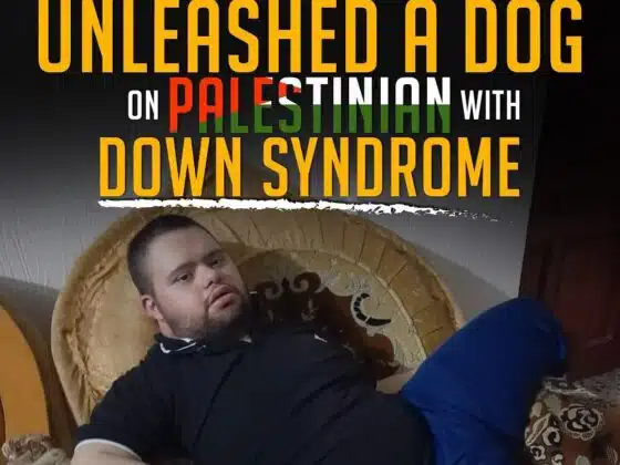 ISRAEL UNLEASHED A DOG ON PALESTINIAN WITH DOWN SYNDROME