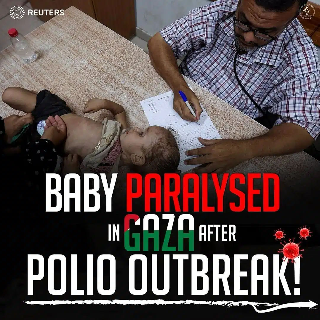 BABY PARALYSED IN GAZA AFTER POLIO OUTBREAK!