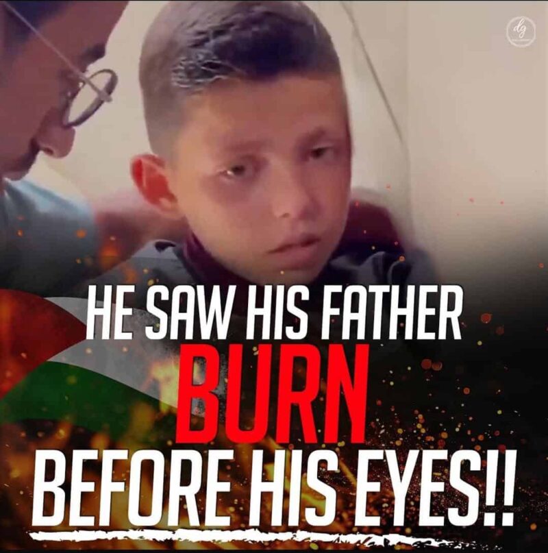 HE SAW HIS FATHER BURN BEFORE HIS EYES!!