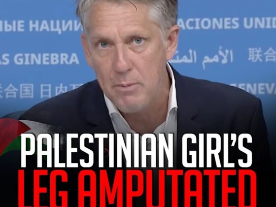 Heartbreaking Story: Palestinian Girl's Leg Amputated – James Elder, UNICEF Spokesperson