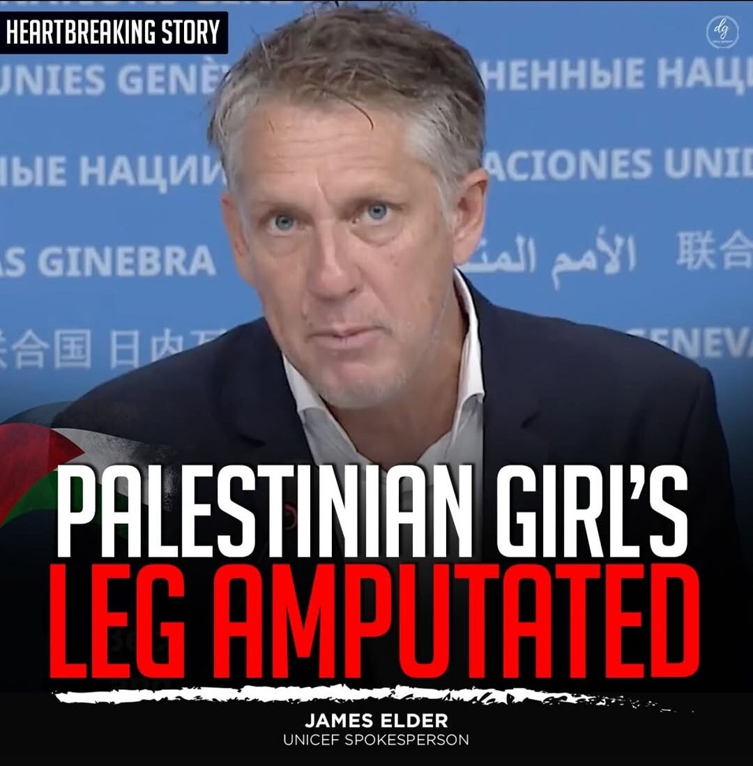 Heartbreaking Story: Palestinian Girl's Leg Amputated – James Elder, UNICEF Spokesperson