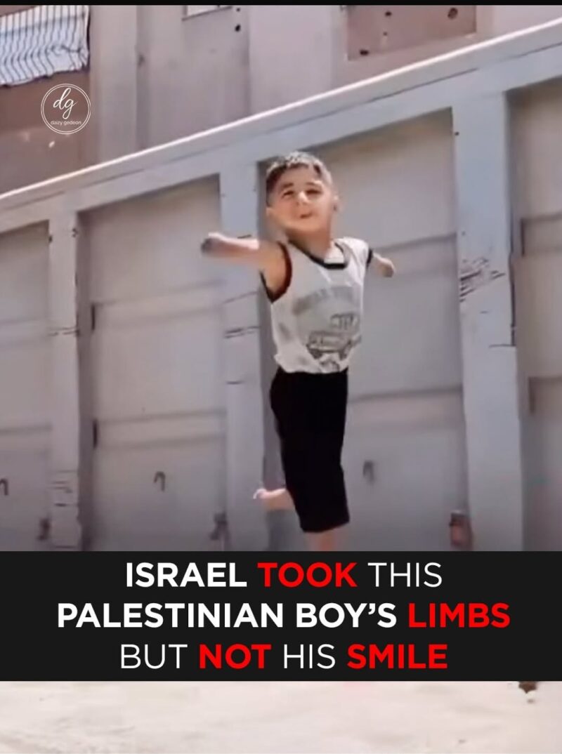 Israel Took This Palestinian Boy’s Limbs — But Not His Smile