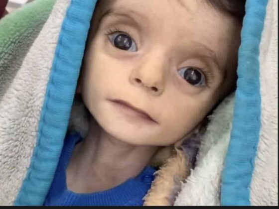 Sensitive Content: Baby Dies as Israel Accused of Starvation Tactics in Gaza