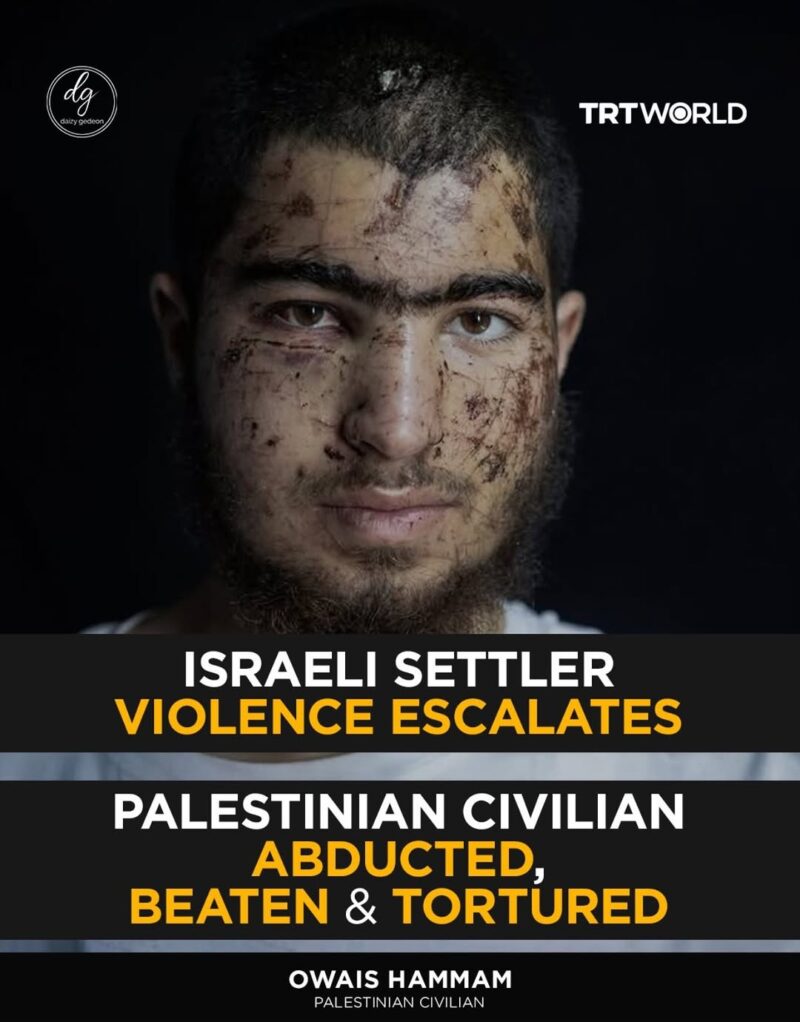 Israeli Settler Violence Escalates as Palestinian Civilian Owais Hammam Is Abducted, Beaten and Tortured – TRTWorld