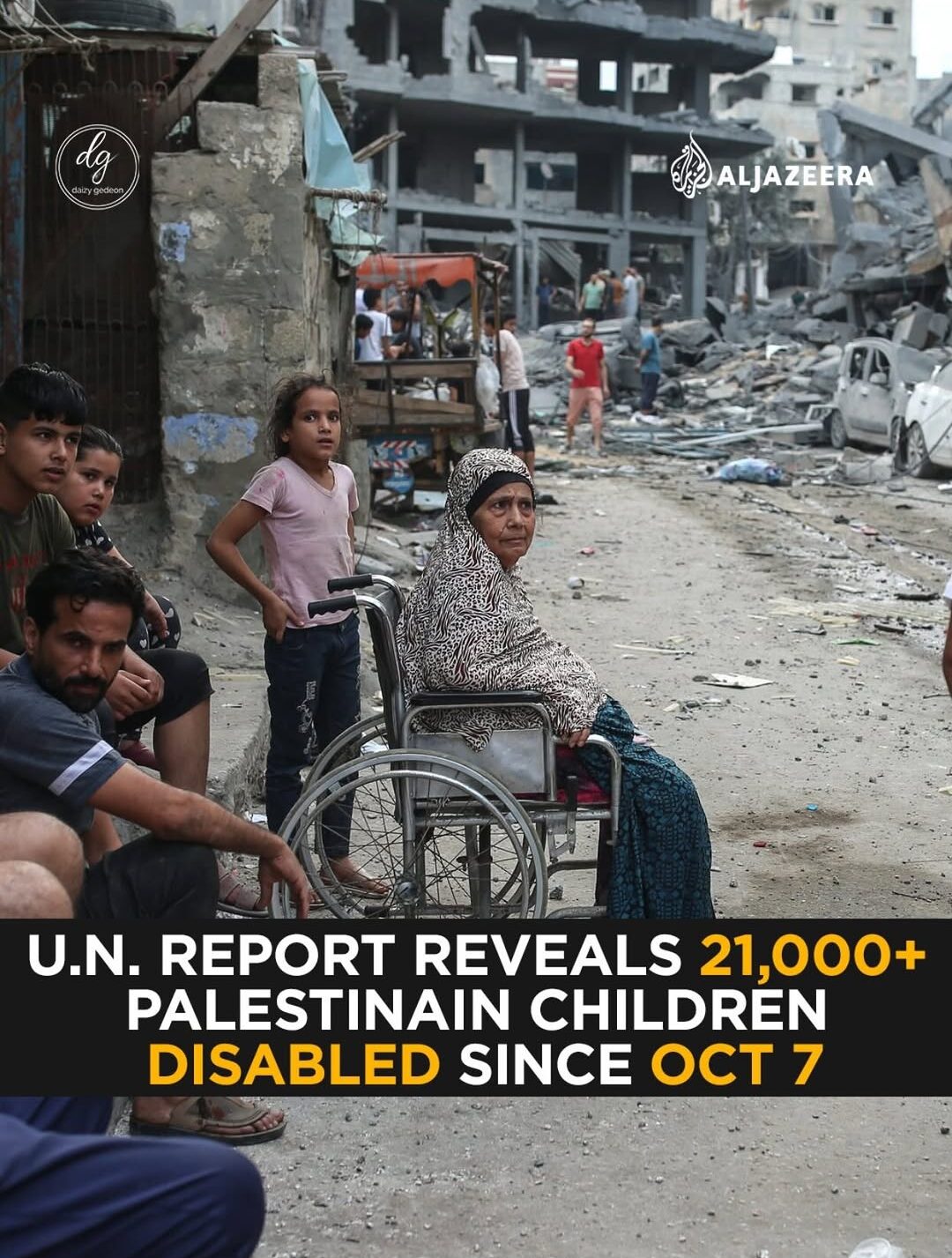 UN report reveals over 21000 Palestinian children disabled since Oct 7
