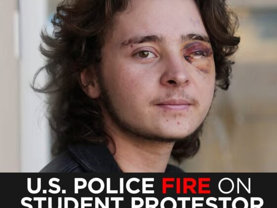 “Blinded for Life for Protesting: Middle East Eye Reports U.S. Police Shot Student Protester Kaden Rummler”