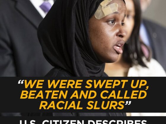 Minnesota DFL: ‘We Were Swept Up, Beaten & Called Racial Slurs’ — U.S. Citizen Says ICE Arrest Left Her With a Concussion